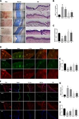 Luteolin Prevents UVB-Induced Skin <mark class="highlighted">Photoaging</mark> Damage by Modulating SIRT3/ROS/MAPK Signaling: An in vitro and in vivo Studies